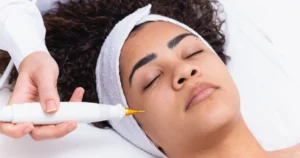 A young woman is receiving a Jet Plasma cosmetic skin treatment in Niceville, FL | Blissful Beauty Bar