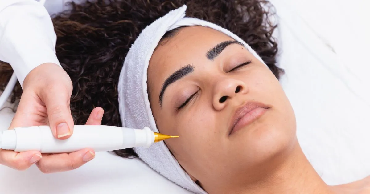 A young woman is receiving a Jet Plasma cosmetic skin treatment in Niceville, FL
